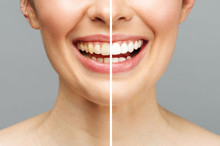 Estetica o cosmetica dentale, quali sono le differenze sostanziali?